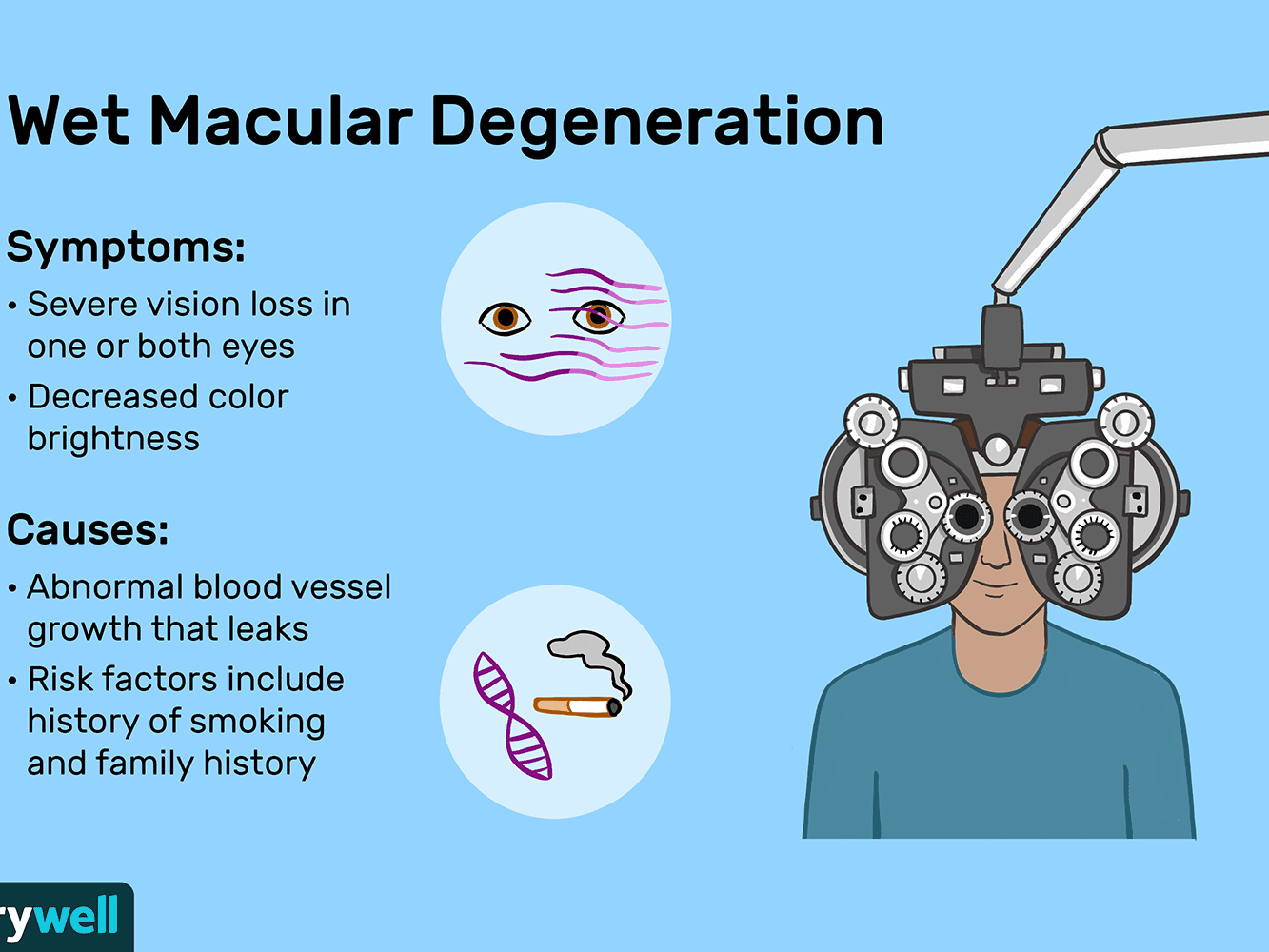 macular degeneration symptoms